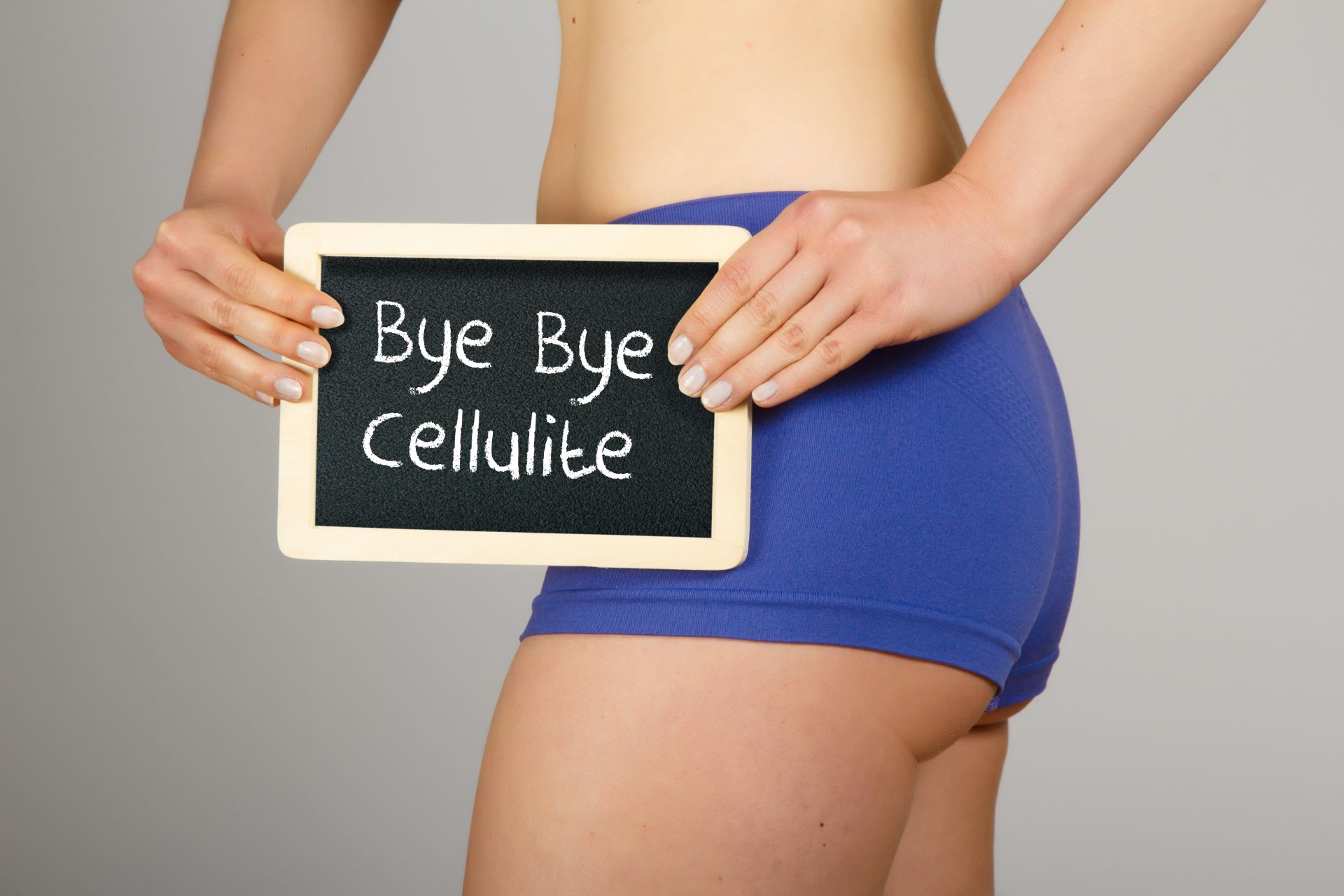 Kobieta w fioletowych spodenkach trzyma tabliczkę z napisem bye bye cellulite